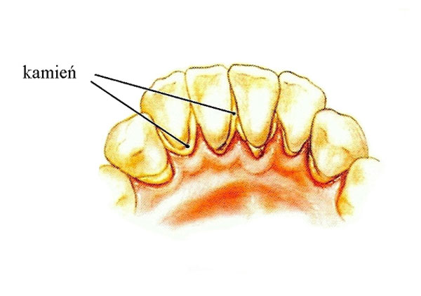 Ortodonta Kłodzko - profilaktyka